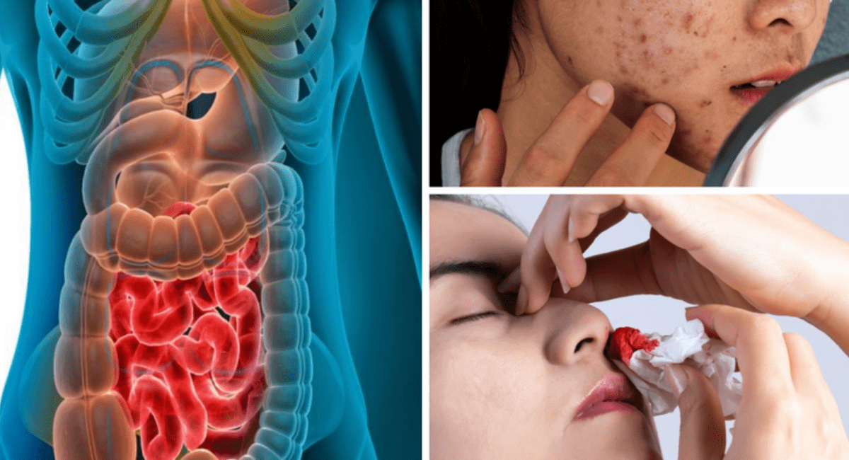 कैंसर के लक्षण - 7 Symptoms of Cancer