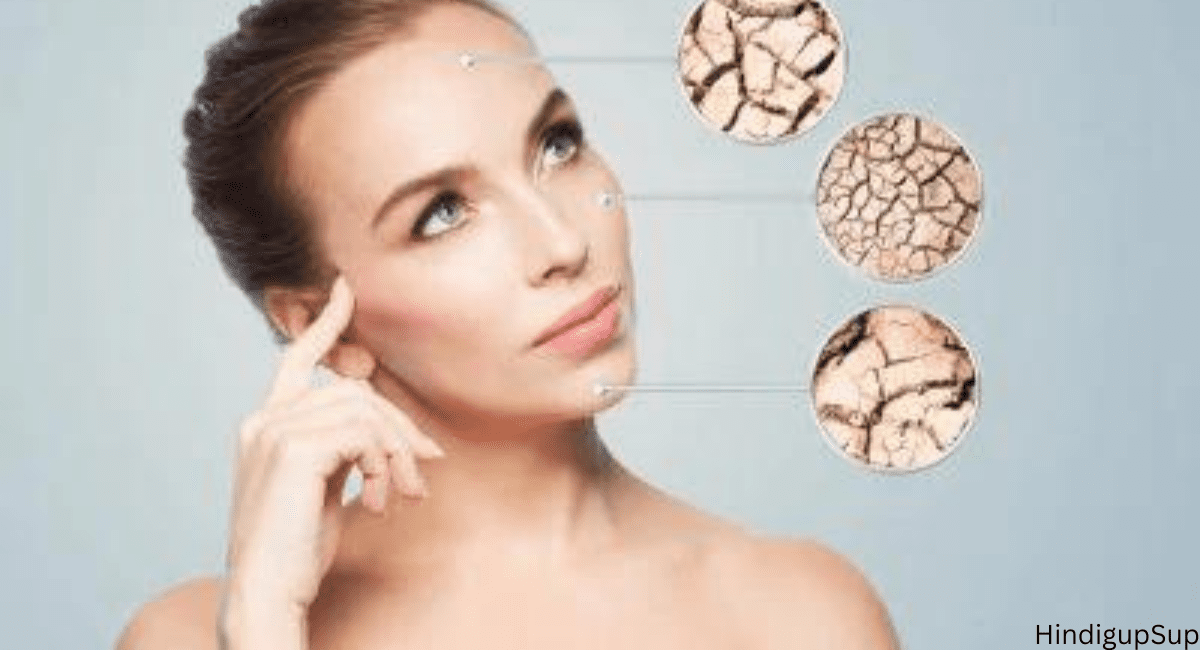 गर्मियों में हाइड्रेटेड स्किन पाने के 8 टिप्स - 8 Tips to Make Your Skin Hydrated in Summer