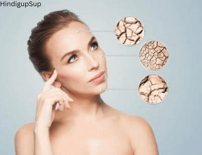 गर्मियों में हाइड्रेटेड स्किन पाने के 8 टिप्स - 8 Tips to Make Your Skin Hydrated in Summer