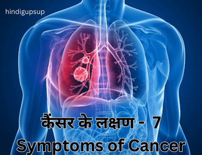 Read more about the article कैंसर के लक्षण – 7 Symptoms of Cancer