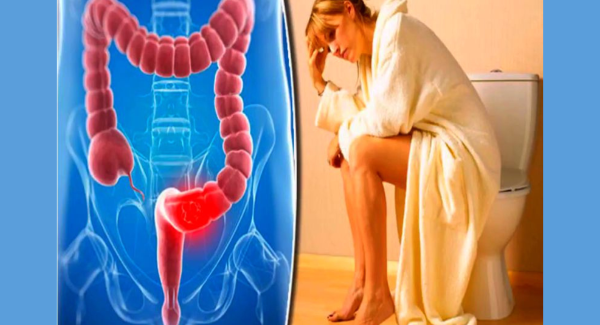 पाइल्स से छुटकारा पाने के घरेलू उपाय - 9 Home Remedies to Get Rid of Piles 8 पाइल्स से छुटकारा पाने के घरेलू उपाय - 9 Home Remedies to Get Rid of Piles