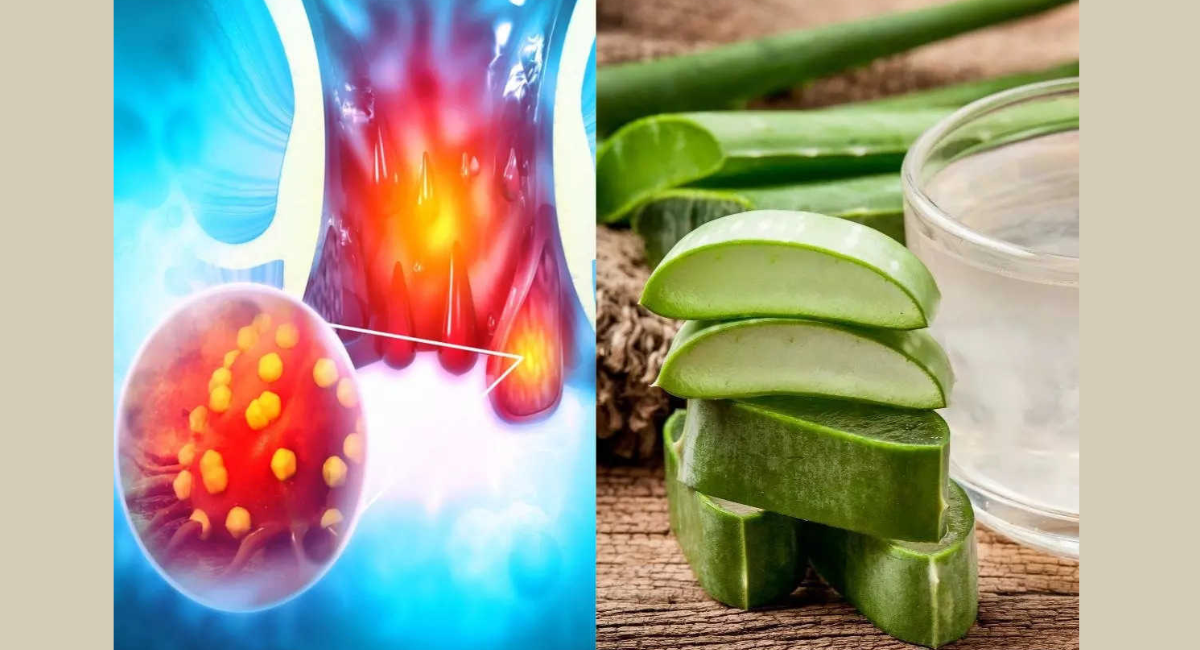 पाइल्स से छुटकारा पाने के घरेलू उपाय - 9 Home Remedies to Get Rid of Piles 3 पाइल्स से छुटकारा पाने के घरेलू उपाय - 9 Home Remedies to Get Rid of Piles