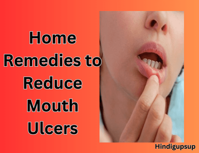Read more about the article मुंह के छाले कम करने के घरेलू नुस्खे कौन से हैं – Which Home Remedies to Reduce Mouth Ulcers