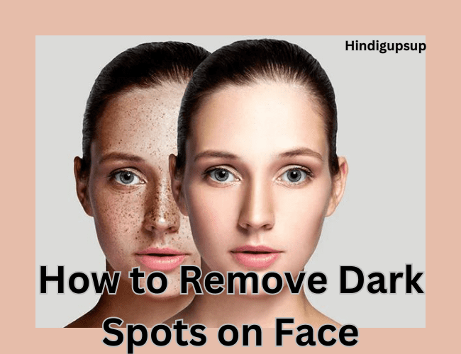 You are currently viewing चेहरे के काले दाग धब्बे को हटाने के घरेलू उपाय क्या है – How to Remove Dark Spots on Face