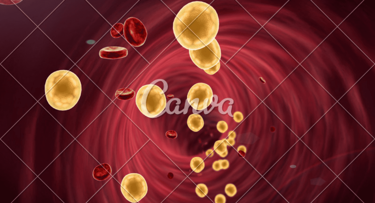 कोलेस्ट्रोल क्या है - Symptoms of Cholesterol 3 कोलेस्ट्रोल क्या है - Symptoms of Cholesterol