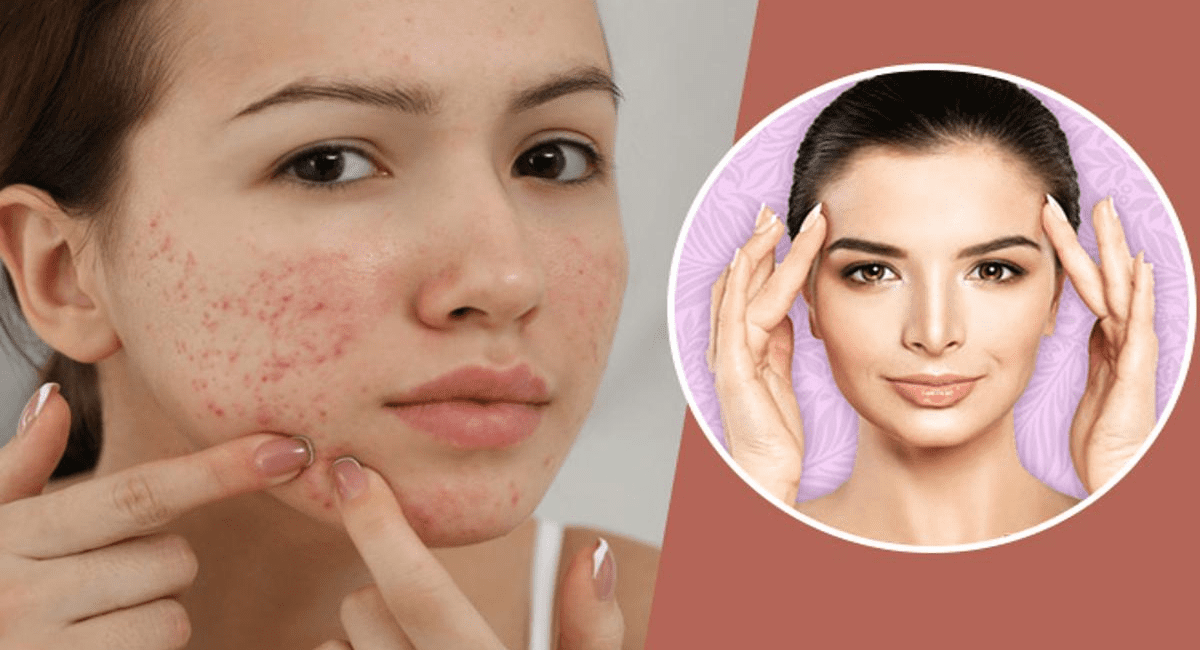 मुल्तानी मिट्टी के 5 फायदे और उपयोग - Benefits of Multani Mitti 6 मुल्तानी मिट्टी के फायदे और उपयोग - Benefits of Multani Mitti