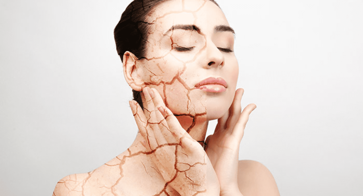 मुल्तानी मिट्टी के 5 फायदे और उपयोग - Benefits of Multani Mitti 5 मुल्तानी मिट्टी के फायदे और उपयोग - Benefits of Multani Mitti