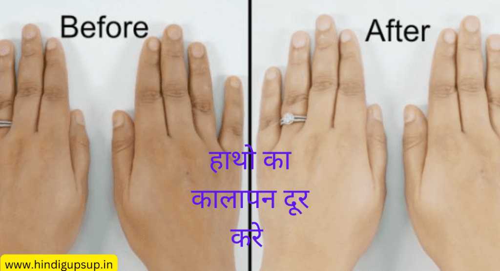 Remove the Blackness of Hands by 7 Tips