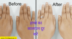 Read more about the article हाथों का कालापन दूर करना है तो ये 7 नुस्खा आएगा काम – Remove the Blackness of Hands by 7 Tips