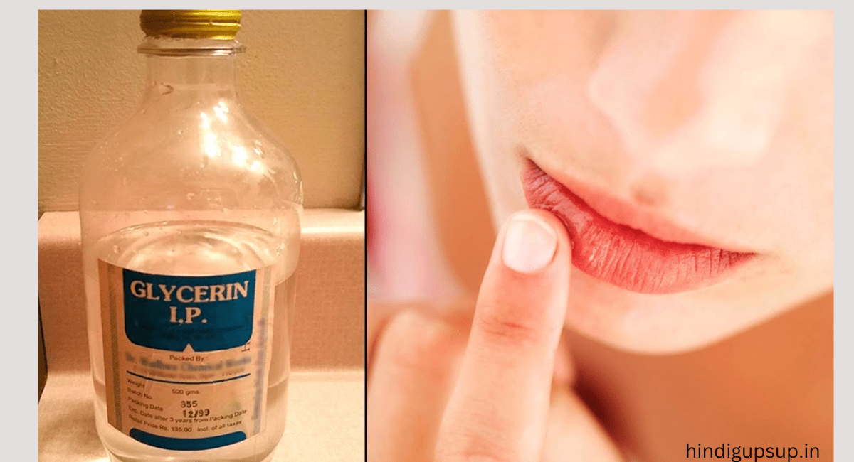 ड्राई होठों से परेशान है तो करें ये उपाय, सूखे होंठों के लिए घरेलू नुस्खे - 8 Home Remedies for Dry Lips