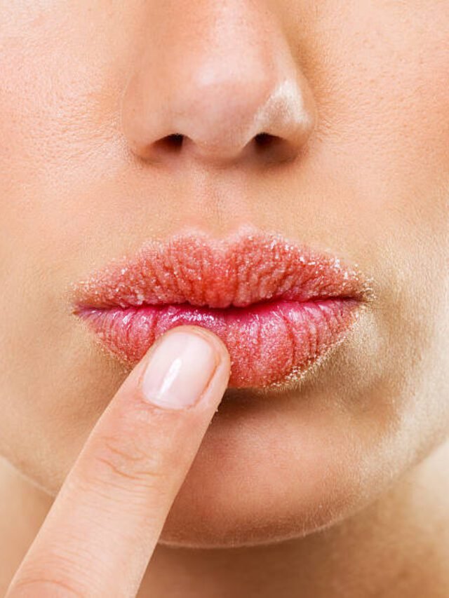 ड्राई होठों से परेशान है तो करें यह उपाय- Home Remedies for Dry Lips