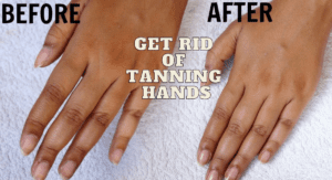 Read more about the article हाथों की टैनिंग हटाने के 5 घरेलू उपाय – Get Rid of Tanning Hands