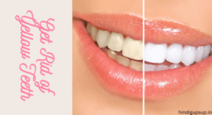 Read more about the article दांतों का पीलापन दूर करने के उपाय, दांतों का पीलापन दूर करने के घरेलू नुस्खे – Remedies to Get Rid of Yellow Teeth
