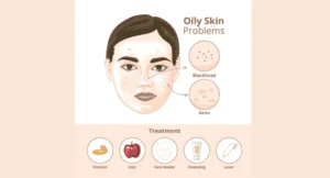 ऑयली स्किन के लिए बेस्ट मॉइस्चराइजर - Best Moisturizer for Oily Skin